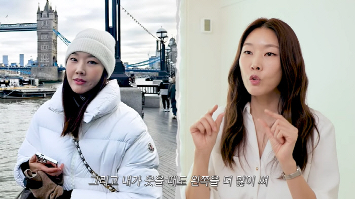 한혜진, 침 성형 후 확 달라진 얼굴..."양볼 두께 두 배 차이 났었다…