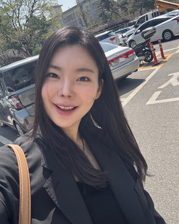 '윤남기♥' 이다은, 안타까운 소식 전했다..."입꼬리염으로 고생 중"