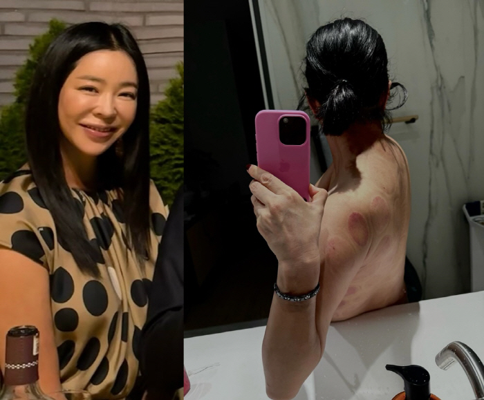 이혜영, 상의 탈의한 모습에 깜짝…