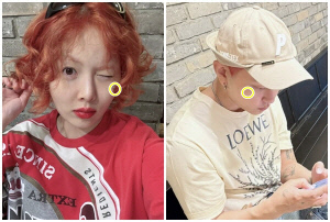 현아, 전신타투 지웠는데…이번엔 '♥용준형' 따라 커플 피어싱[SCin스타]