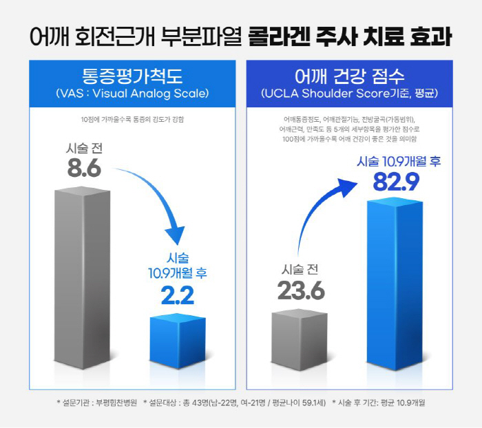 "어깨 콜라겐주사, 치료 10개월 이후에도 효과 지속"…부평힘찬병원 "통…