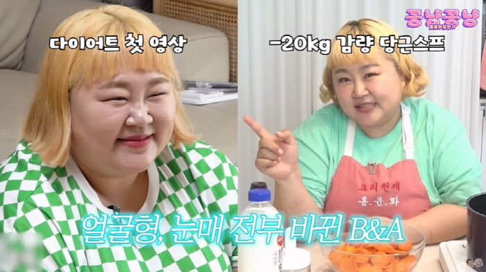 "위고비 절대 아냐" 홍윤화, 2달만 20kg 감량 후 반쪽된 얼굴 '충…