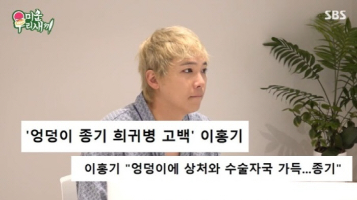 이홍기, 20년째 '희귀병' 투병 고백..."수술 8번, 흉터로 대중목욕…
