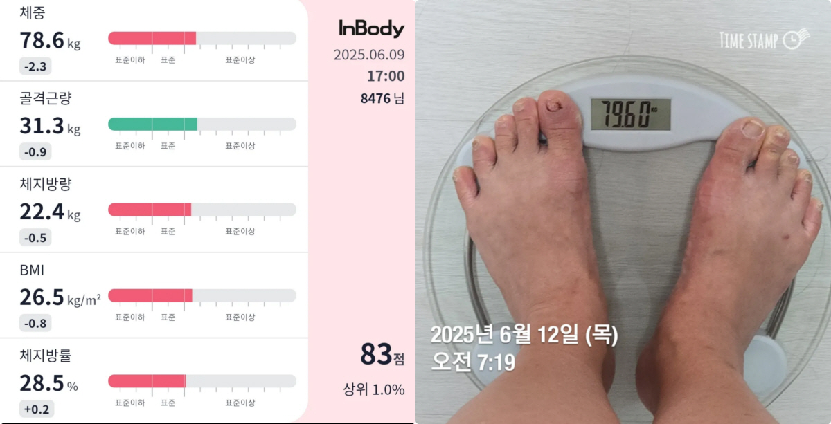 '72kg 감량' 미나 시누이, 조작 논란에 입열었다 "의심·비난에 78…