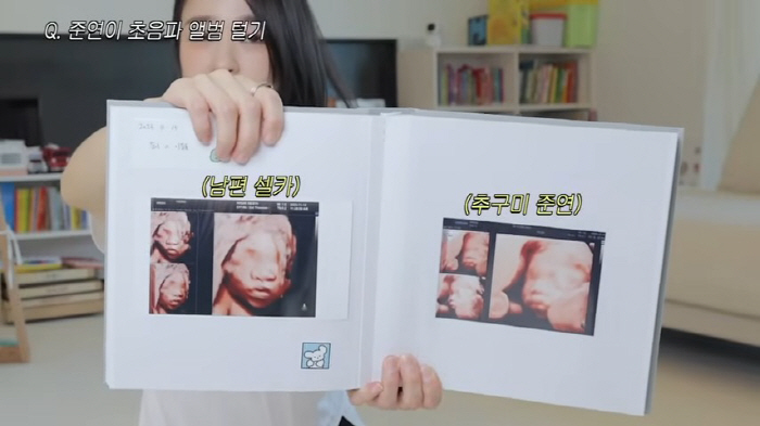 “남편 얼굴 닮은 子 열달 품기 싫어…초음파 다시 찍자고" ‘9살 연상♥…