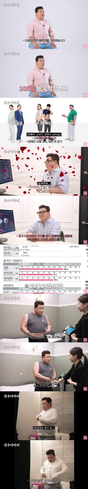 윤정수, 105kg→지방흡입 부작용 호소 