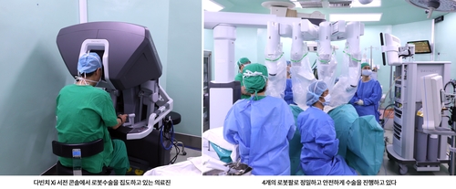 단국대병원, 최첨단 로봇수술 시스템 '다빈치 Xi' 본격 가동