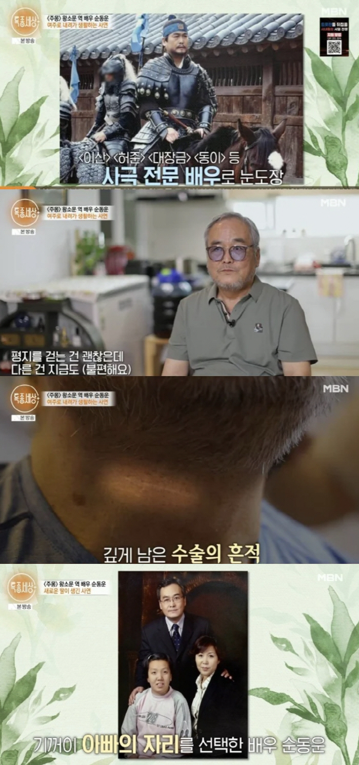순동운 "낙상사고로 전신마비, 지적장애 2급 딸 얻어"[SC리뷰]