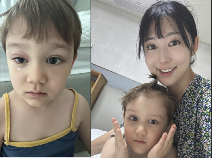 사유리 子 젠, 빨갛게 부어오른 눈 '무슨 일?'...눈도 안 떠질 정도…