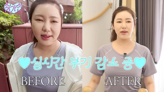 송가인, 45kg 리즈 찍고 더 감량하나...부기 감소 전·후 비교 "무…