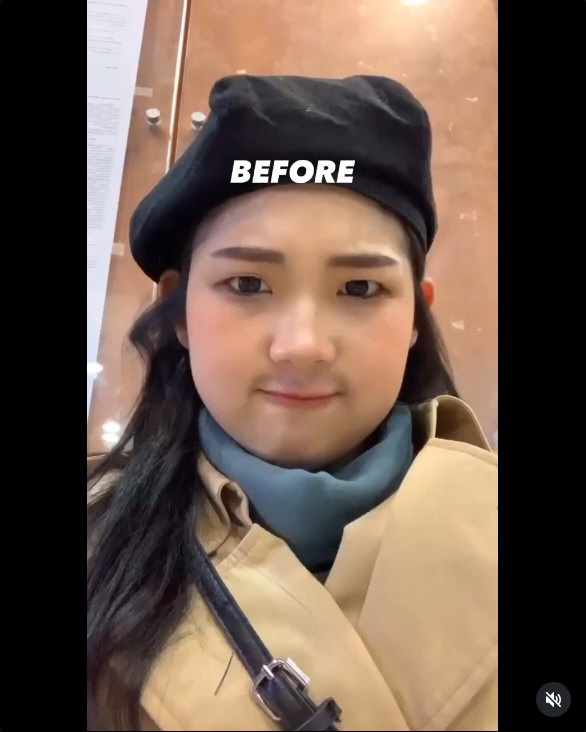 '96→41kg' 최준희, 눈 돌아가는 '비포 애프터'…"살 빼야 할 이…