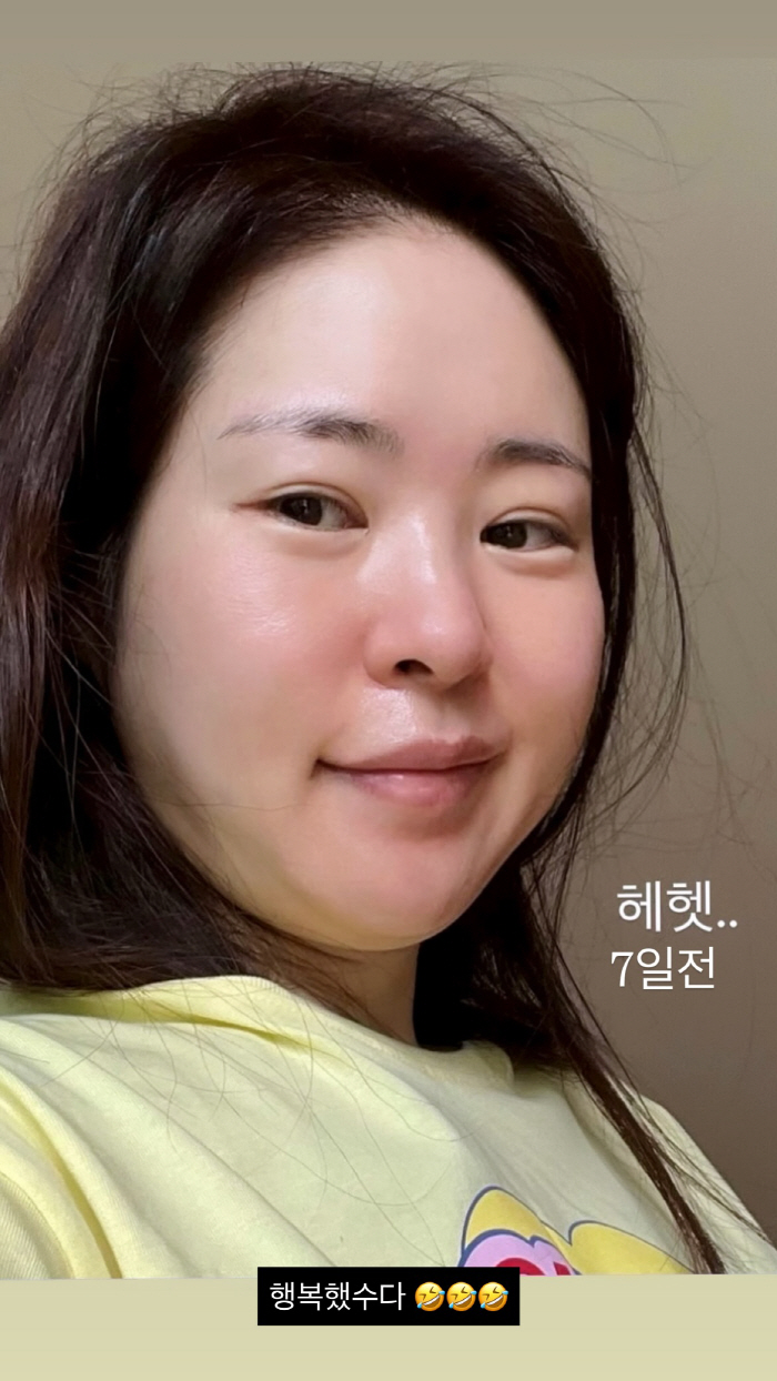 '김태현♥' 미자, 단 5일만 '53→48kg' 감량하다니...충격의 '…