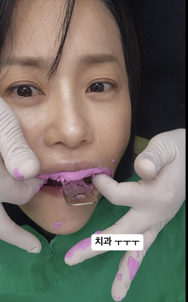 '54세' 고현정도 치과는 무서워..인형 꼭 쥐고 "ㅜㅜ"