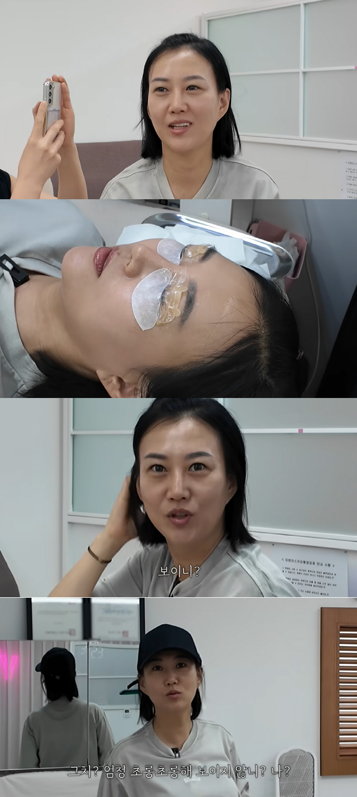 장윤정, 솔직 고백 “눈 시술 받았다”..더 커진 눈매