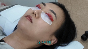 장윤정, 속눈썹 펌 현장 깜작 공개…