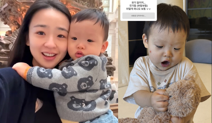 '초보맘' 손연재, 16개월 子 육아 중 S.0.S "모기 알러지 부들.…