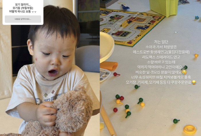 '금융인♥' 손연재, 16개월 子 '병원行' 눈물...모기 알러지에 "약…