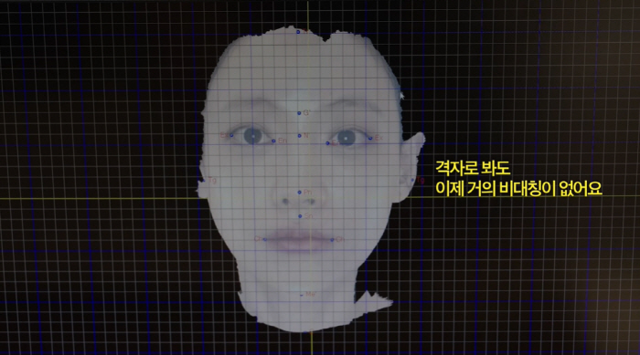 38세 오연서 "이 사진, 공개하기 싫었다"..시술 후 달라진 얼굴 깜짝