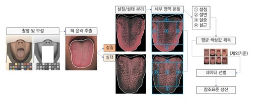 "성별·연령별 정상 혀 색깔은…" 한의학연, 국가참조표준 개발