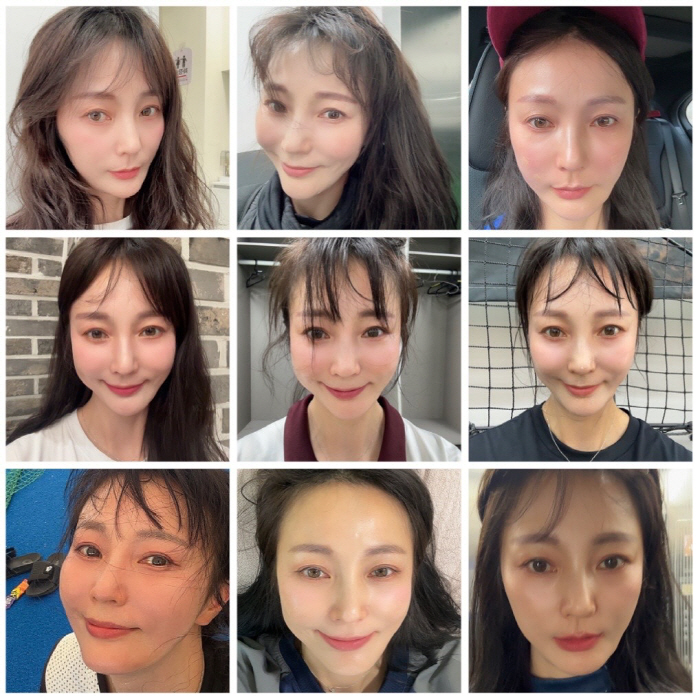 안혜경, 줄기세포 맞은 지 한 달.."변화 확실히 보여"