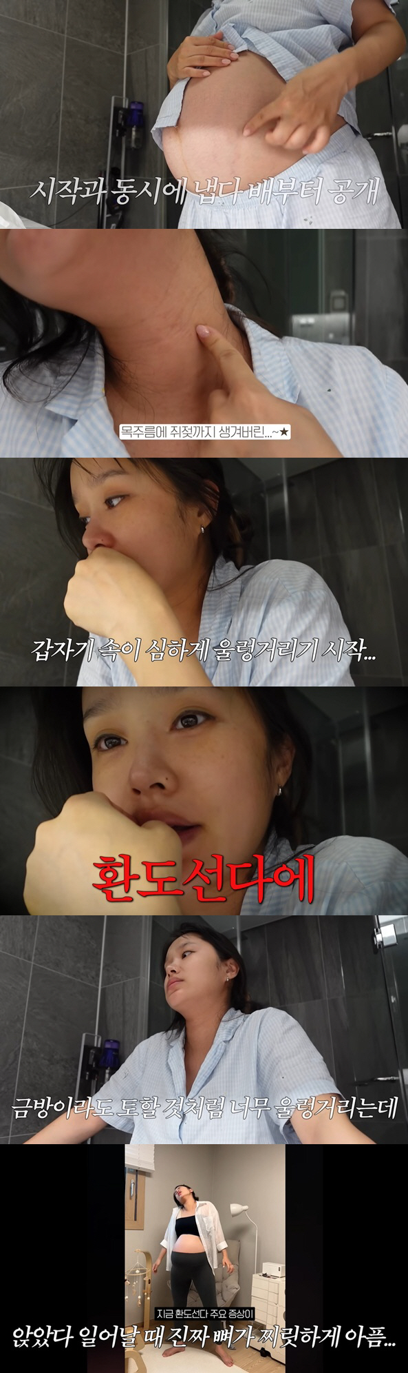 헤이지니, 심각한 만삭 고충 "환도선다에 쥐젖·목주름..손까지 탱탱 부어…