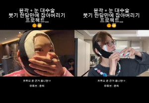'故최진실 딸' 최준희, '광대 성형' 후 달라진 얼굴 