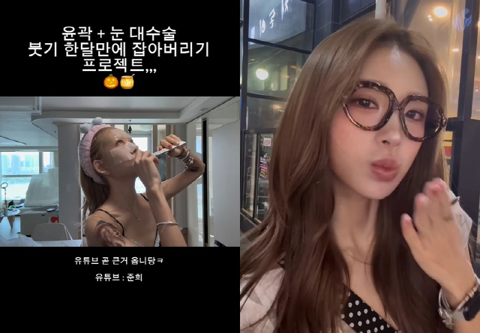 '故최진실 딸' 최준희, '광대 성형' 후 달라진 얼굴 "뼈는 안 건드려…