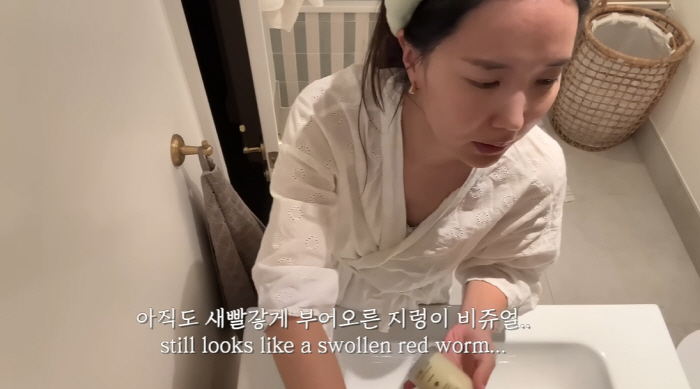 '영국남자♥' 국가비, 제왕절개 흉터 심각 "출산 1년 지났는데 빨간 지렁이같아"