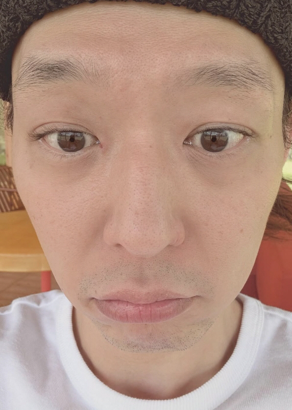 [SCin스타] 박유천, '마약→은퇴 번복' 후 근황..넓어진 이마→늘어…