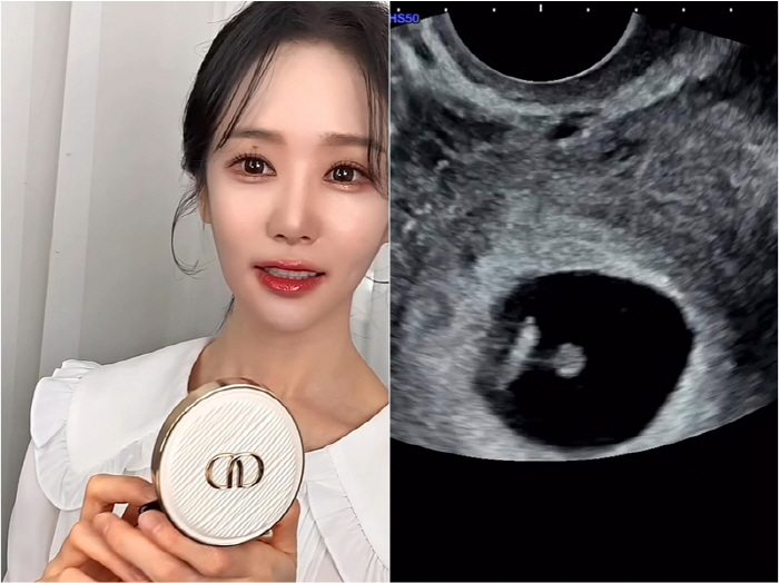 [전문] "테이프 깔까" 16기 옥순, 혼전 임신 고백…"소식듣고 눈물로…