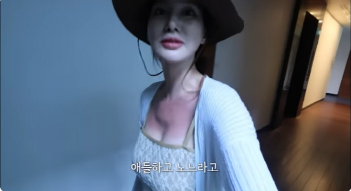 '안정환♥' 이혜원, 발리 여행 중 화상 입었다 "너무 아파 옷도 못 입…