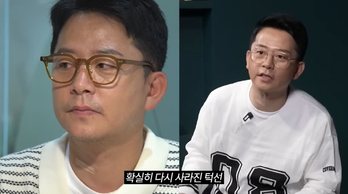 '김지민♥' 김준호, 위고비로 7kg 감량→요요와 리프팅 시술 "턱선 사…