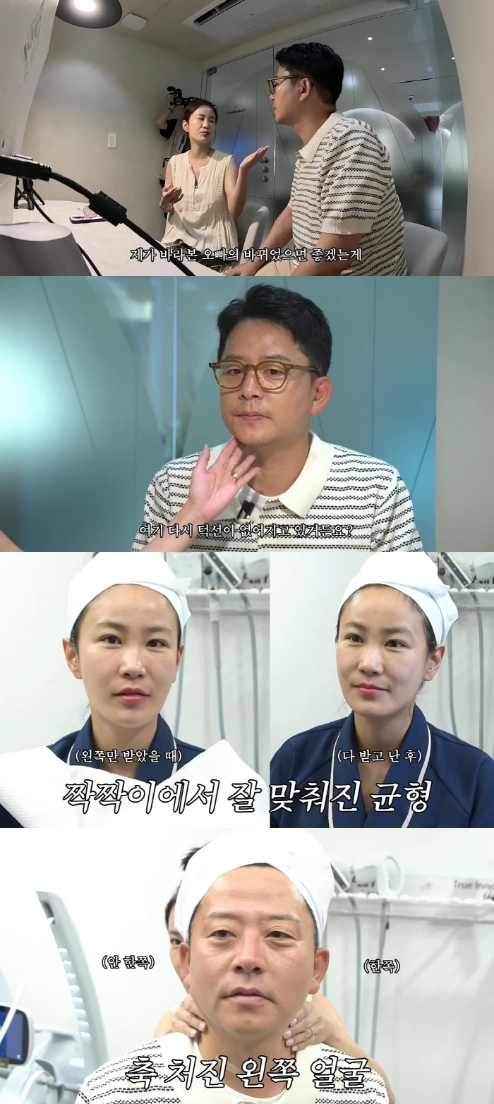 '김지민♥' 김준호, 위고비로 7kg 감량→요요와 리프팅 시술 "턱선 사…
