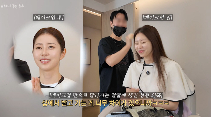 '재혼' 서동주, 달라보이는 얼굴..성형 의혹에 