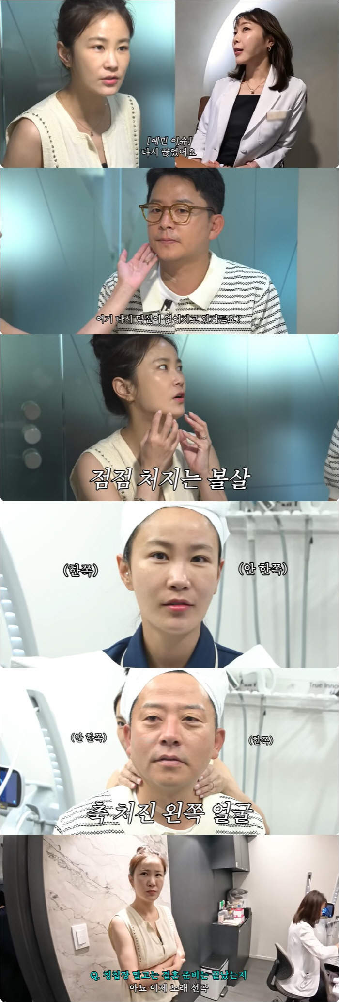김준호, 위고비 부작용 탓 끊자마자 요요왔다 "턱선 없어져"