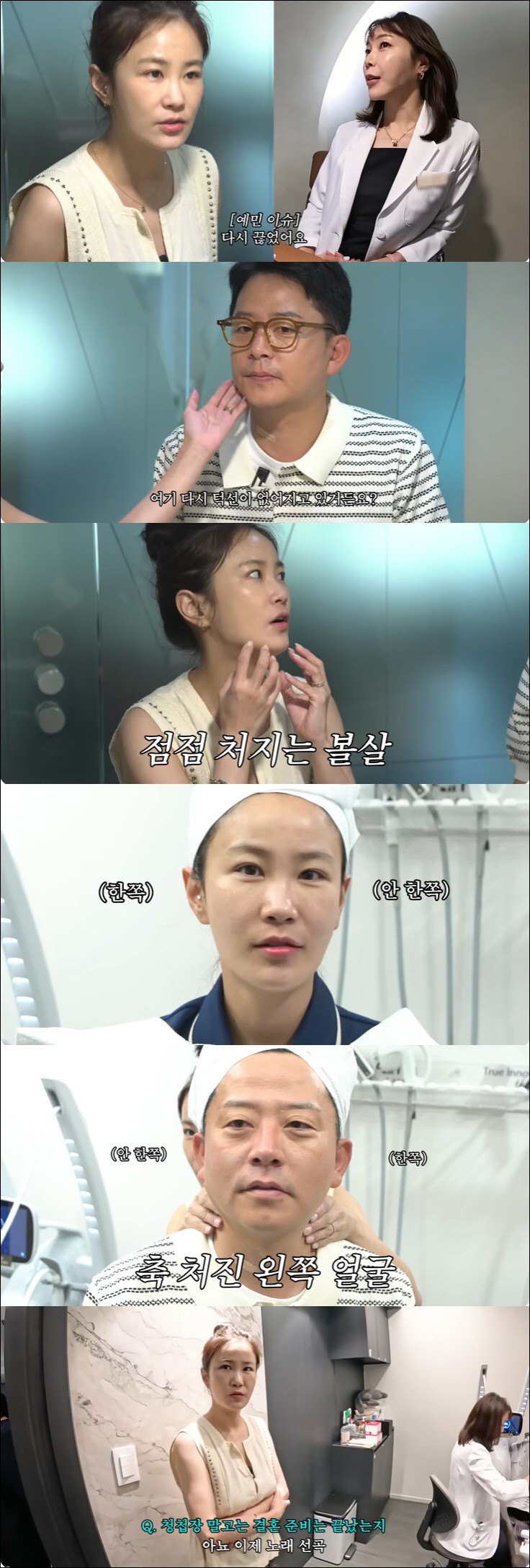 김준호, 위고비 부작용 탓 끊자마자 요요왔다 "턱선 없어져"