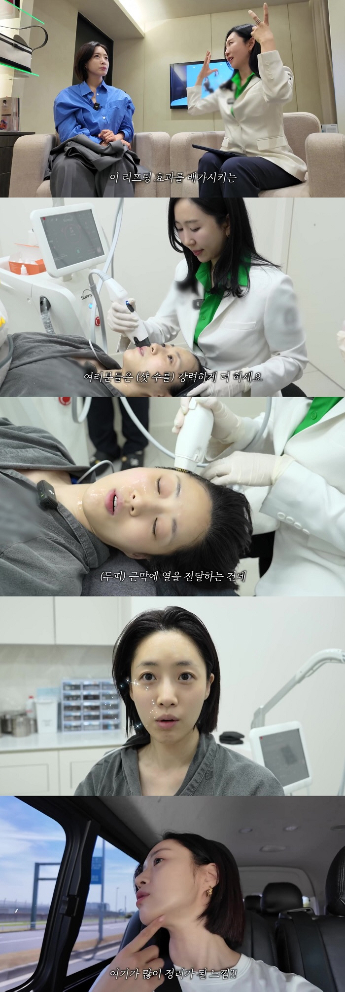 함은정, 리프팅 받고 대만족 “재시술 의사 10,000%”