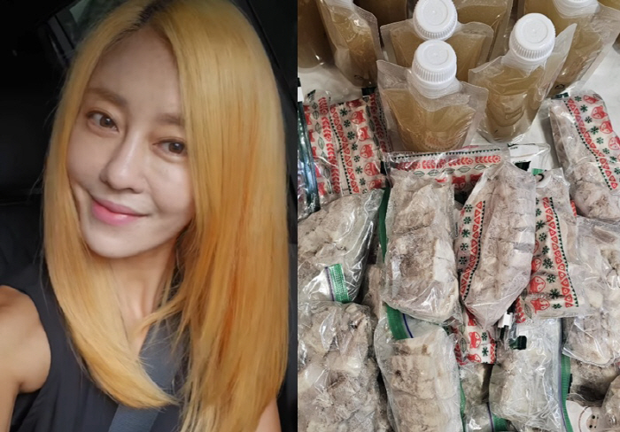 '싱글맘' 이지현, 수술 다음 날에도 집안일 폭주 
