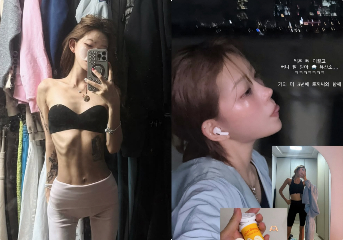 '최진실 딸' 최준희, 골반괴사 고통에도 41kg 유지.."썩은 뼈 이끌…