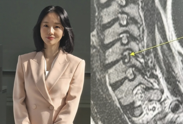 이정현, 트레이닝복에 1000만원대 명품백 포인트...'194억 건물주'…