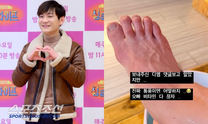 정성호, 통풍 의심에 발 붓고 고통 