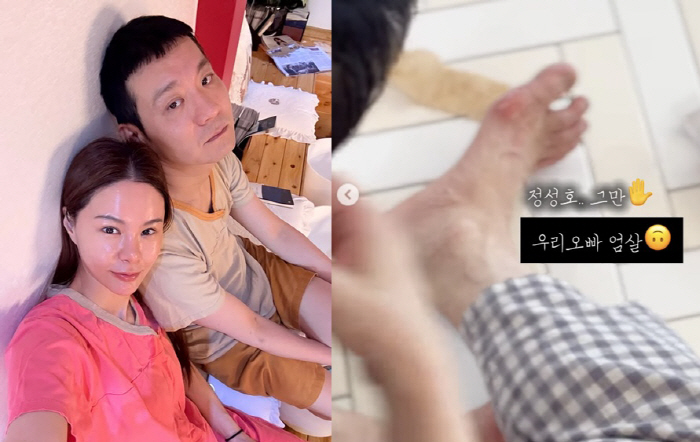 정성호, 통풍 의심에 발 붓고 고통 "하루 500번 아프다 외쳐"