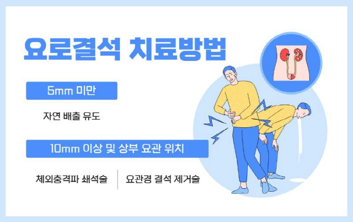 '출산 고통'같은 요로결석, 이 음식 피해야…힘찬병원 "수분 섭취 중요"