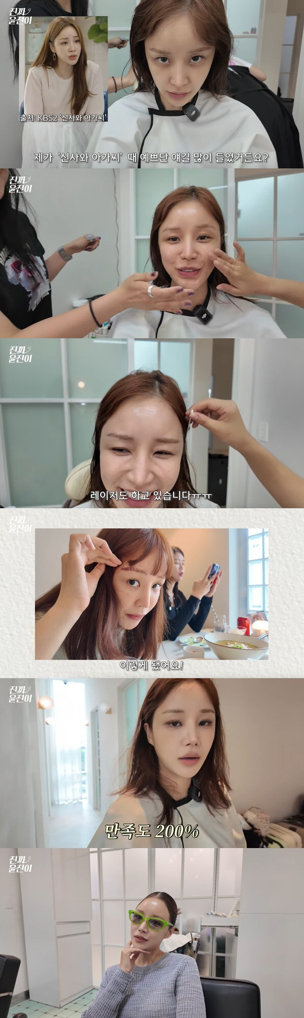 '피부과 2도 화상' 윤진이, 선명한 왼쪽뺨 흉터..메이크업 후 '매끈 …