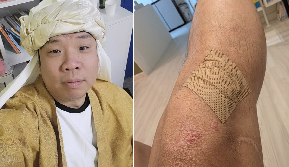 오지헌, 비에 미끄러져 낙차 사고 “핸들 놓쳐..무릎 피범벅”