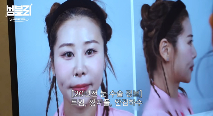 '서준맘' 박세미, 몰린 눈+들린 코 성형 재수술하나..."상담 후 마음…