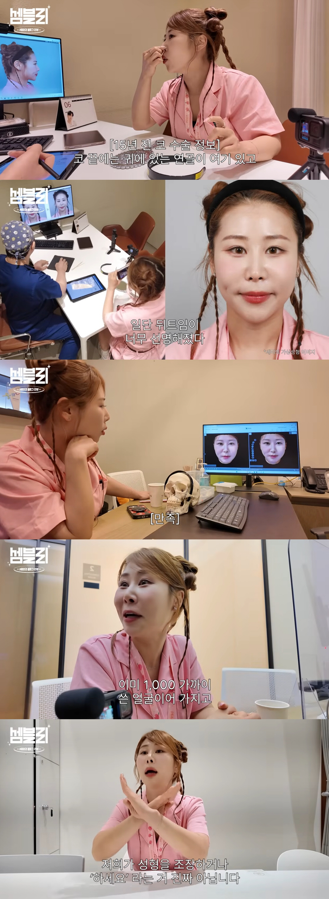 '서준맘' 박세미, 몰린 눈+들린 코 성형 재수술하나..."상담 후 마음…