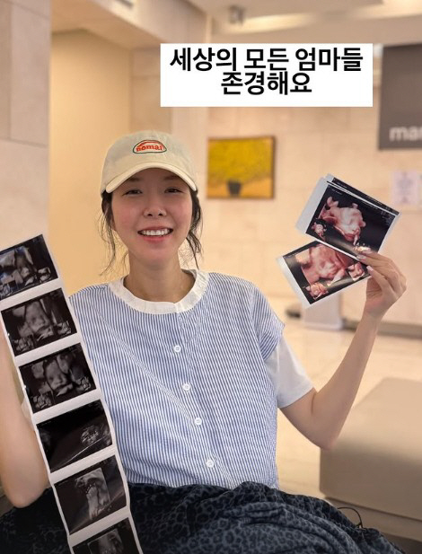 '쌍둥이 임신' 김지혜, '조산 위험' 있었는데..."조금만 걸어도 어지…