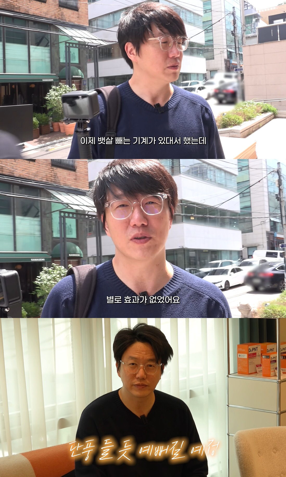 성시경, '꾸밀텐데' 혹평 받더니..피부과서 726만원 플렉스 변신 완료