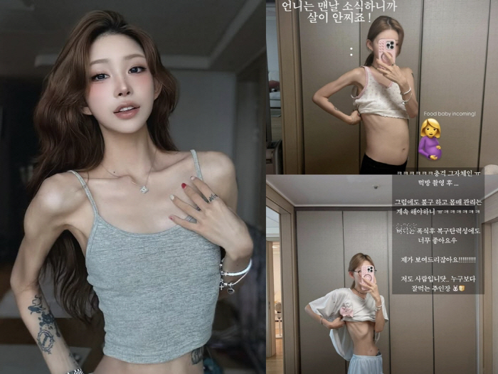 '故 최진실 딸' 최준희, 41kg 뼈말라 팔다리에 배만 볼록 "충격 그…